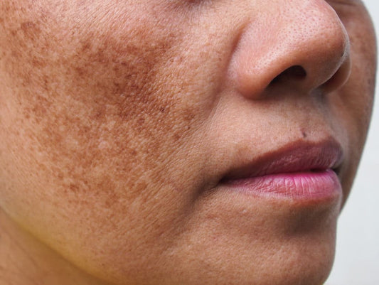 Pigmentation kit
